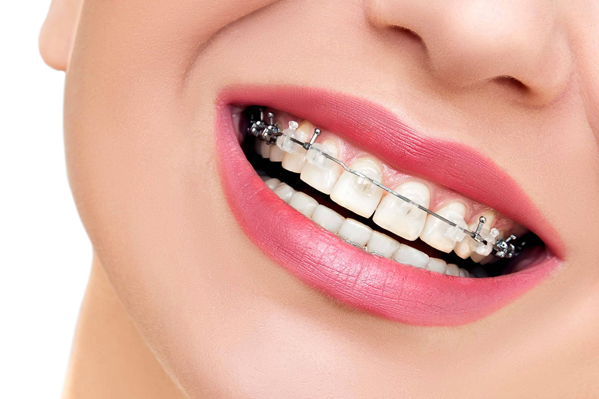https://lacasaodontologia.com.br/wp-content/uploads/2024/04/services-ortodontia.jpg